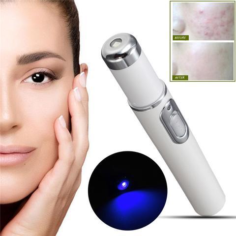 Blue Light Therapy Acne Laser - Urban Mart