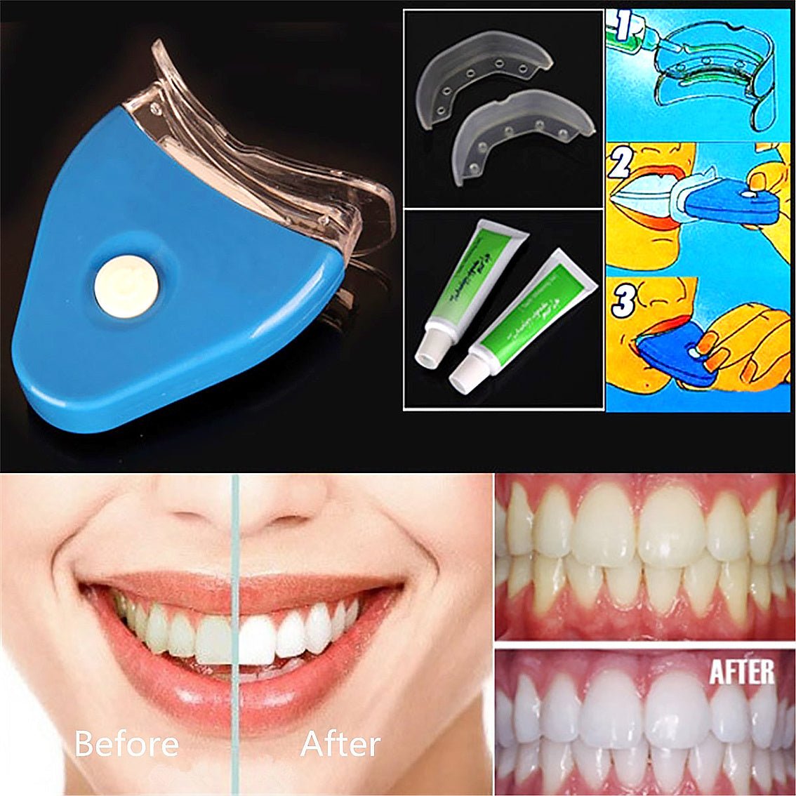 Oral Gel Teeth Tooth Whitening Whitener Dental Bleaching LED - Urban Mart